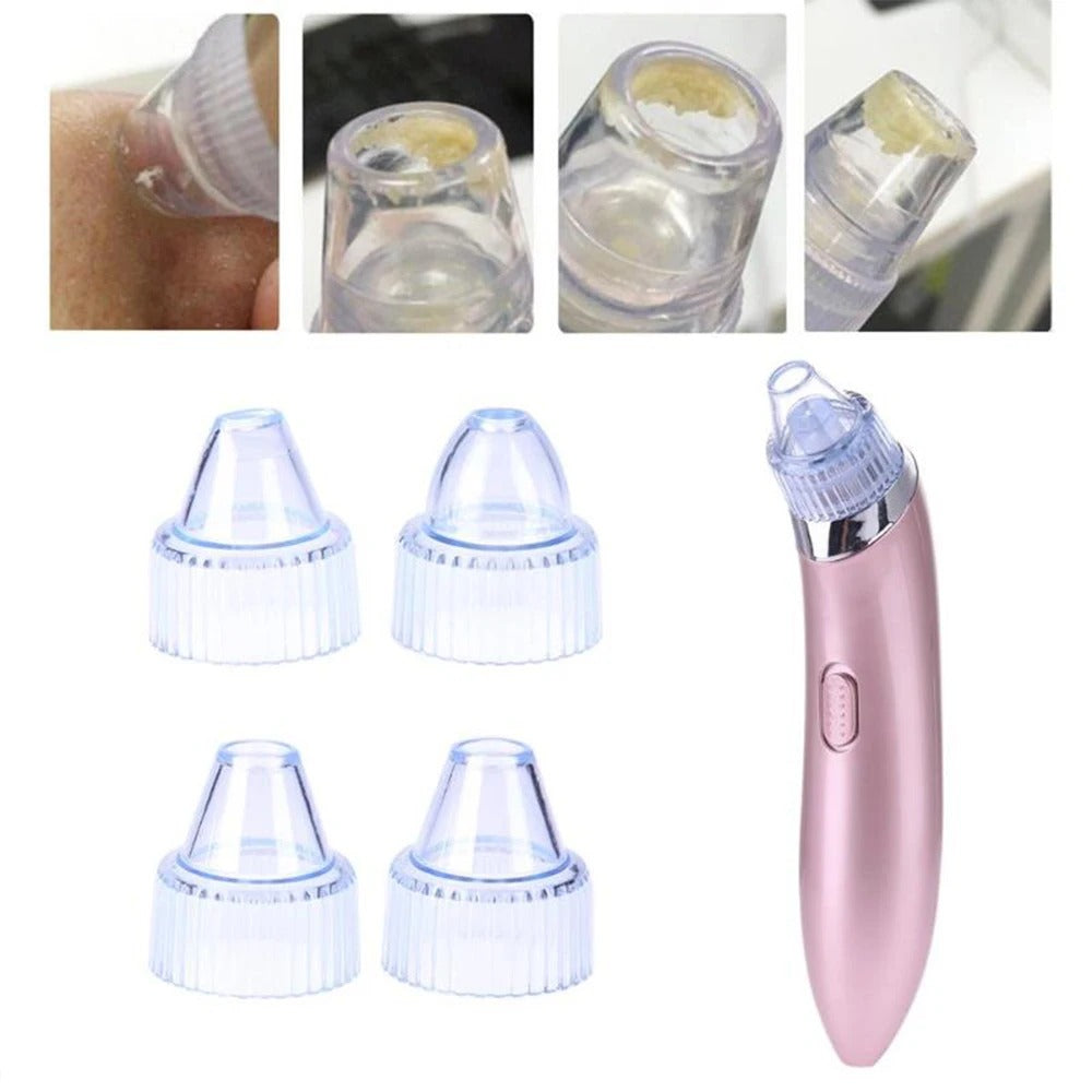 EXTRACTOR DE PUNTOS NEGROS-BLACKHEAD EXTRACTOR